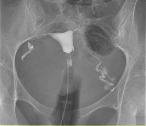 Jmarchn, CC BY-SA 3.0 , via Wikimedia Commons